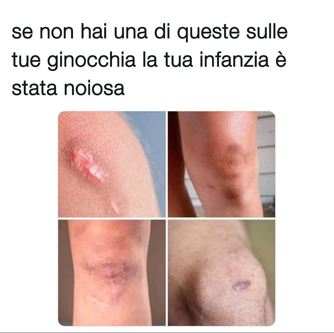 fa ridere perché sono io 