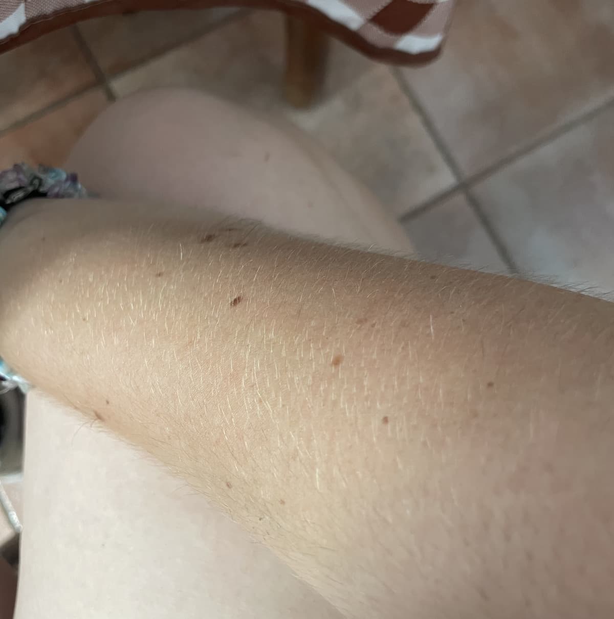 dimmi che non sei andata al mare e hai portato i pantaloni lunghi tutta l’estate senza dirmi che non sei andata al mare e hai portato i pantaloni lunghi tutta l’estate. La differenza di colore tra il mio braccio e la mia coscia: