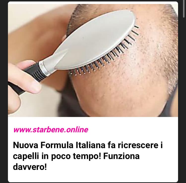 spazzolate le vostre teste calve in modo da far sentire ai vostri capelli inesistenti come sarebbe bello essere pettinati e invogliarli a crescere ? 