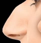 Immagine di Google. Ho un naso così dite che fa tanto schifo ? Mi vedo brutta 