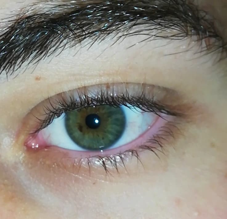 My eyes