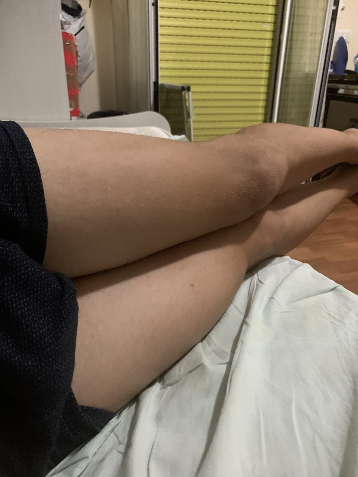 Mostro le cosce così a caso