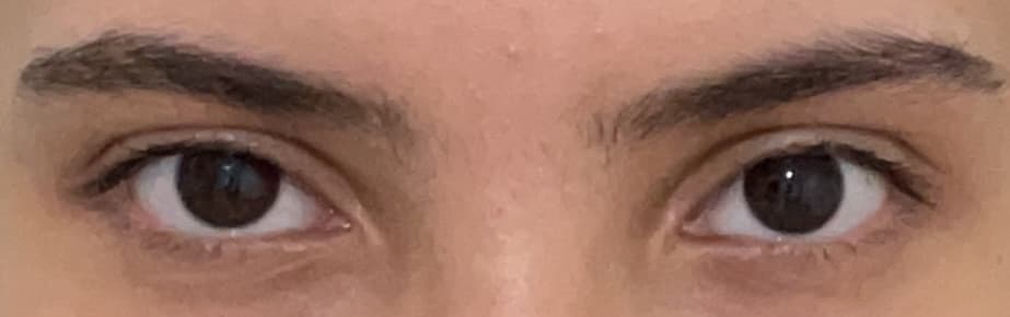 Mai capito la forma dei miei occhi