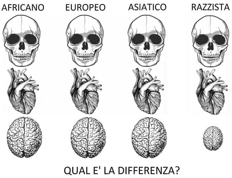 Razzismo 