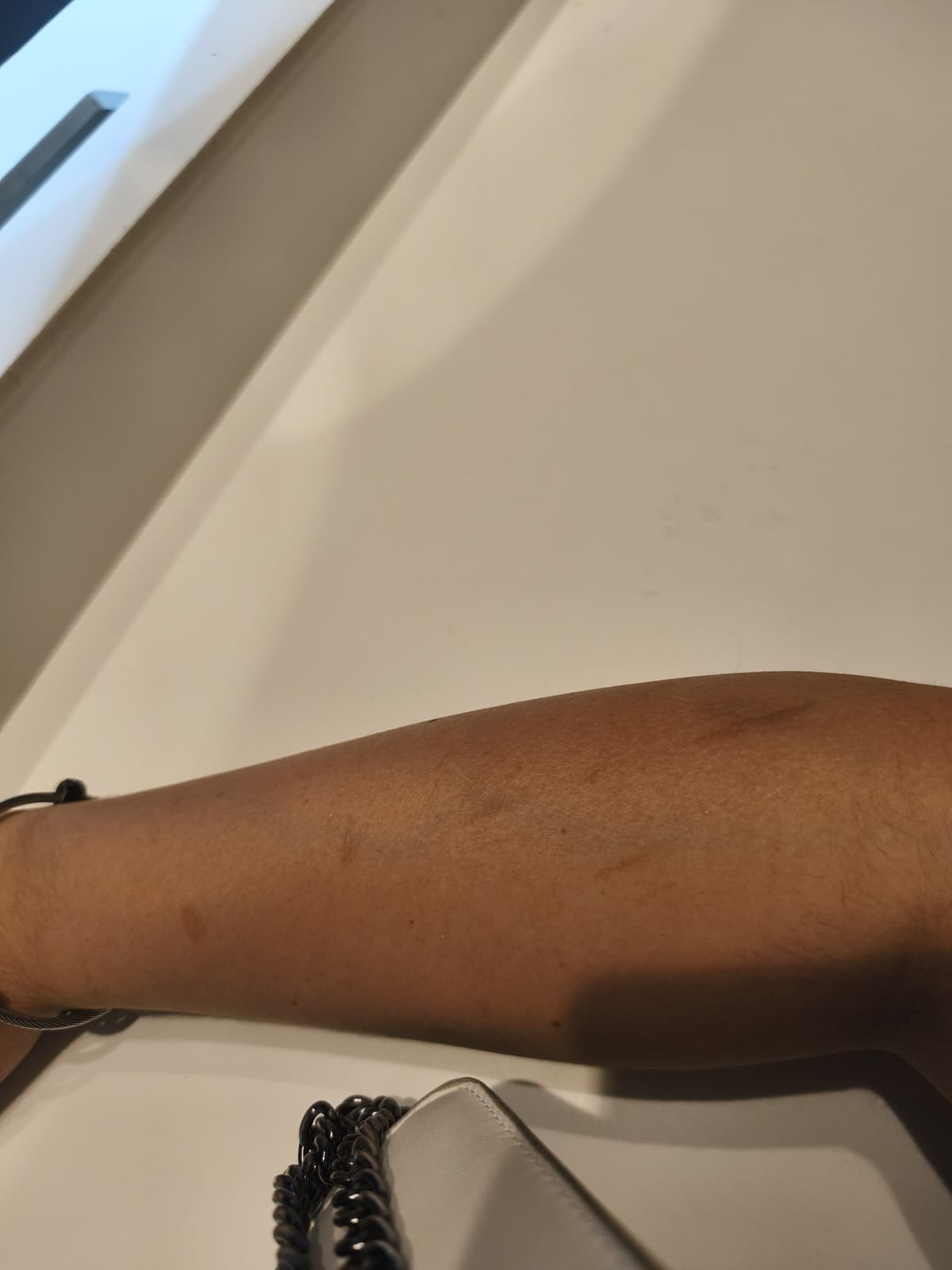 Oggi per la prima dopo anni mi sono rasa i peli del braccio , non l'ho mai fatto perché mi vergognavo un sacco delle cicatrici che mi ero causata..