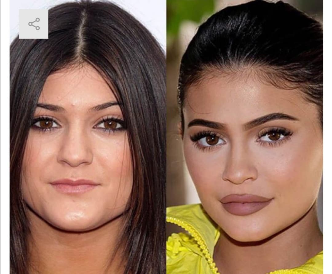 Noi ridiemo e scherziamo...ma questa è kylie jenner da adolescente Vs adesso(23 anni) 