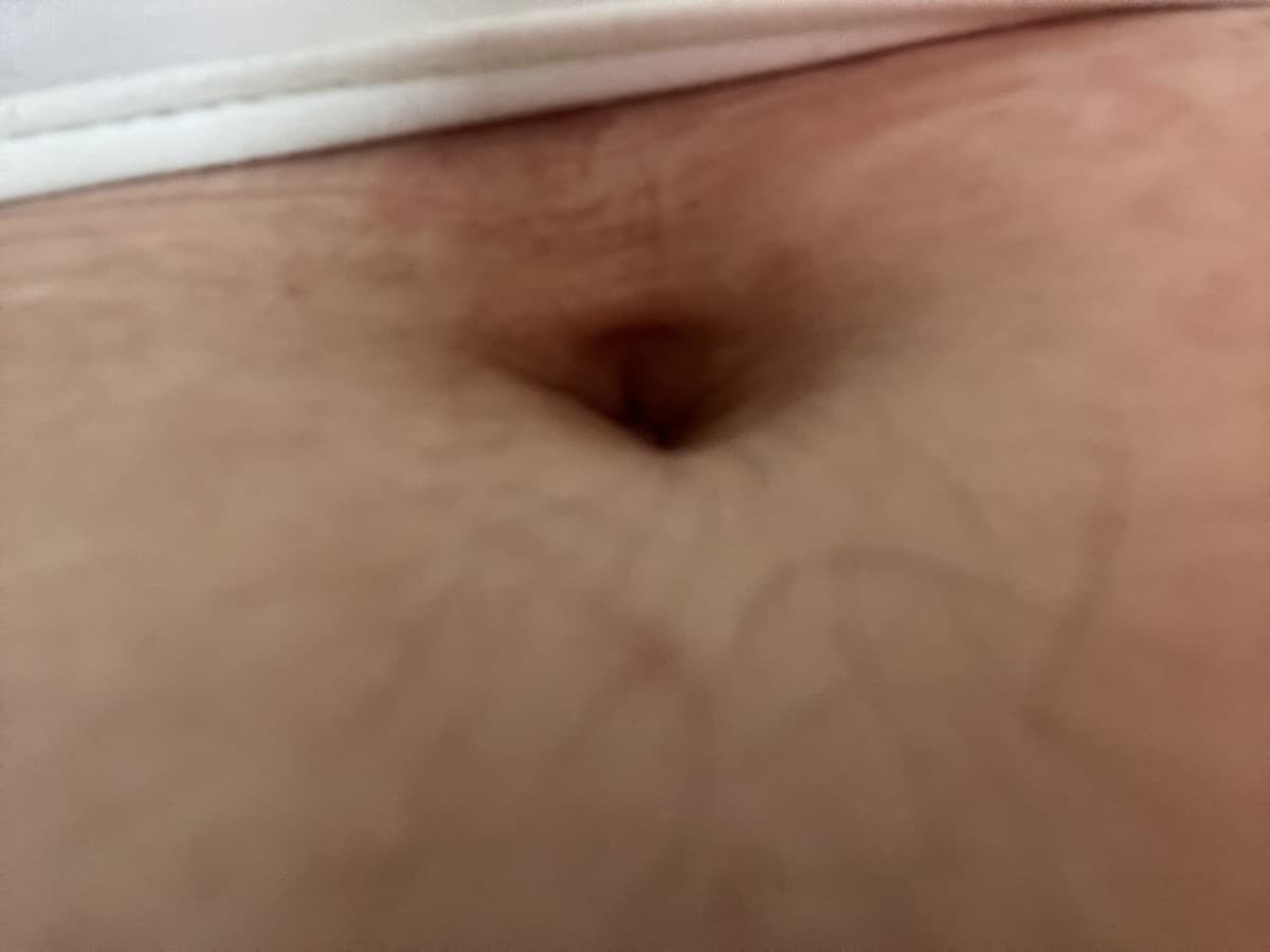 insegreto è un ombelico!