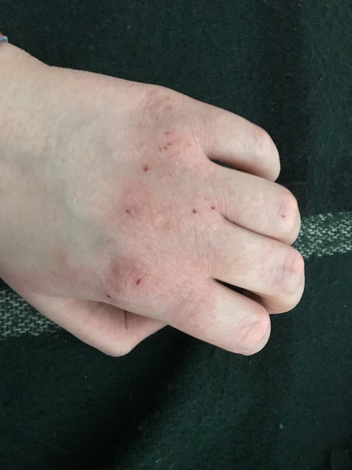 Dimmi che hai le mani rovinate dai continui lavaggi senza dirmi che hai le mani rovinate dai continui lavaggi?non so più che creme mettere