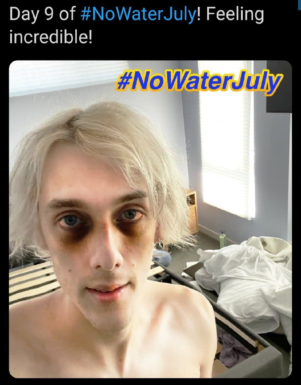 È morto