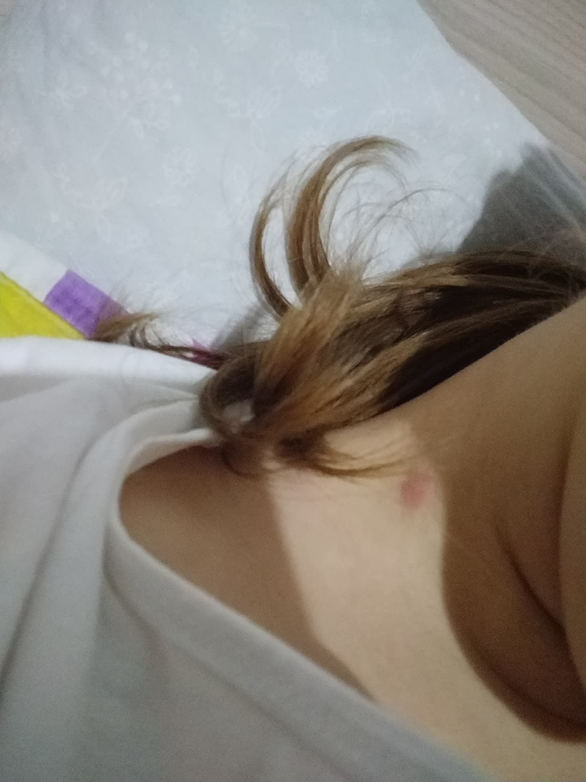 Sembra più un succhiotto o una pizzicata?