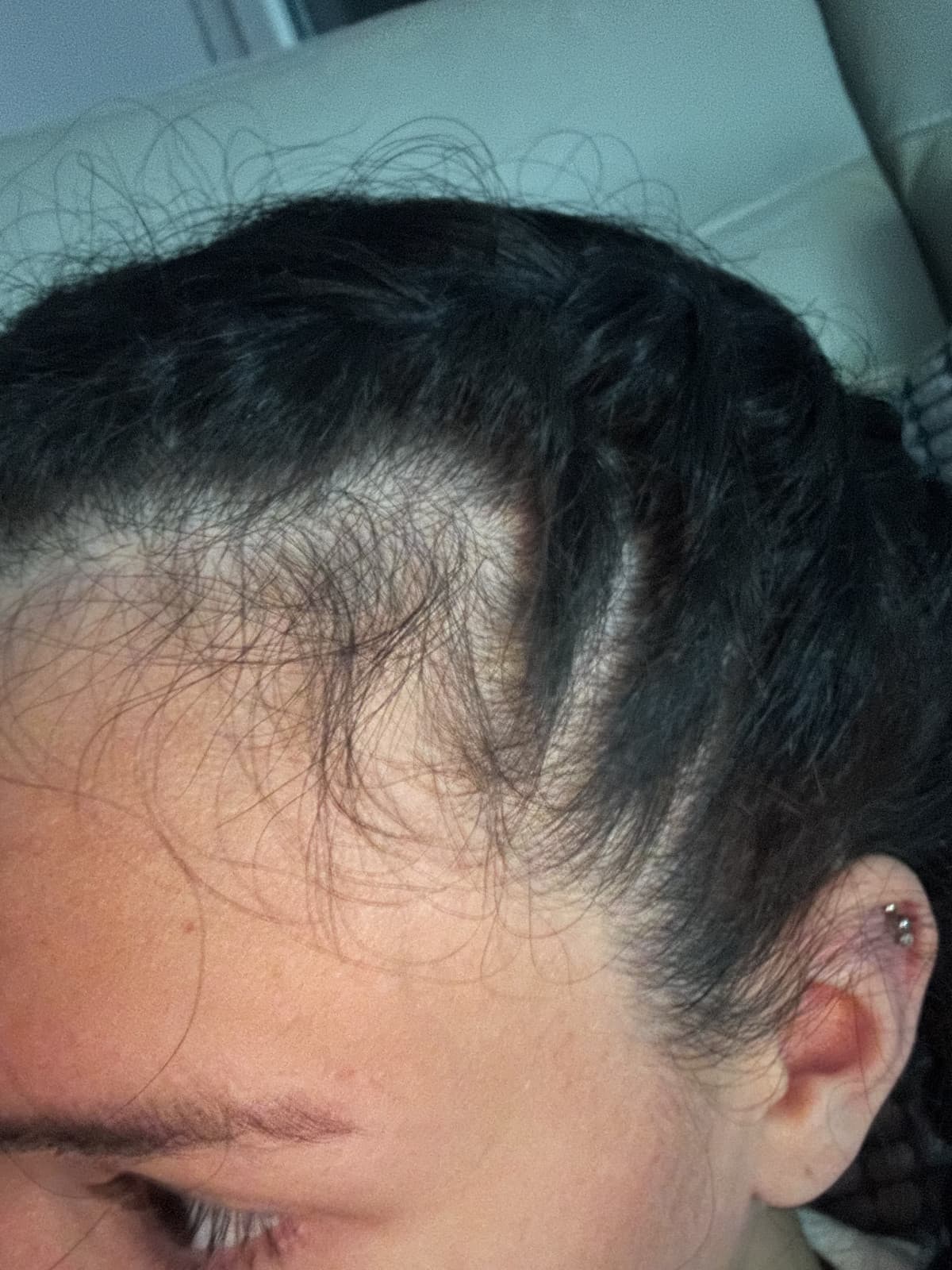 Nessuno ha la hairline come la mia😎