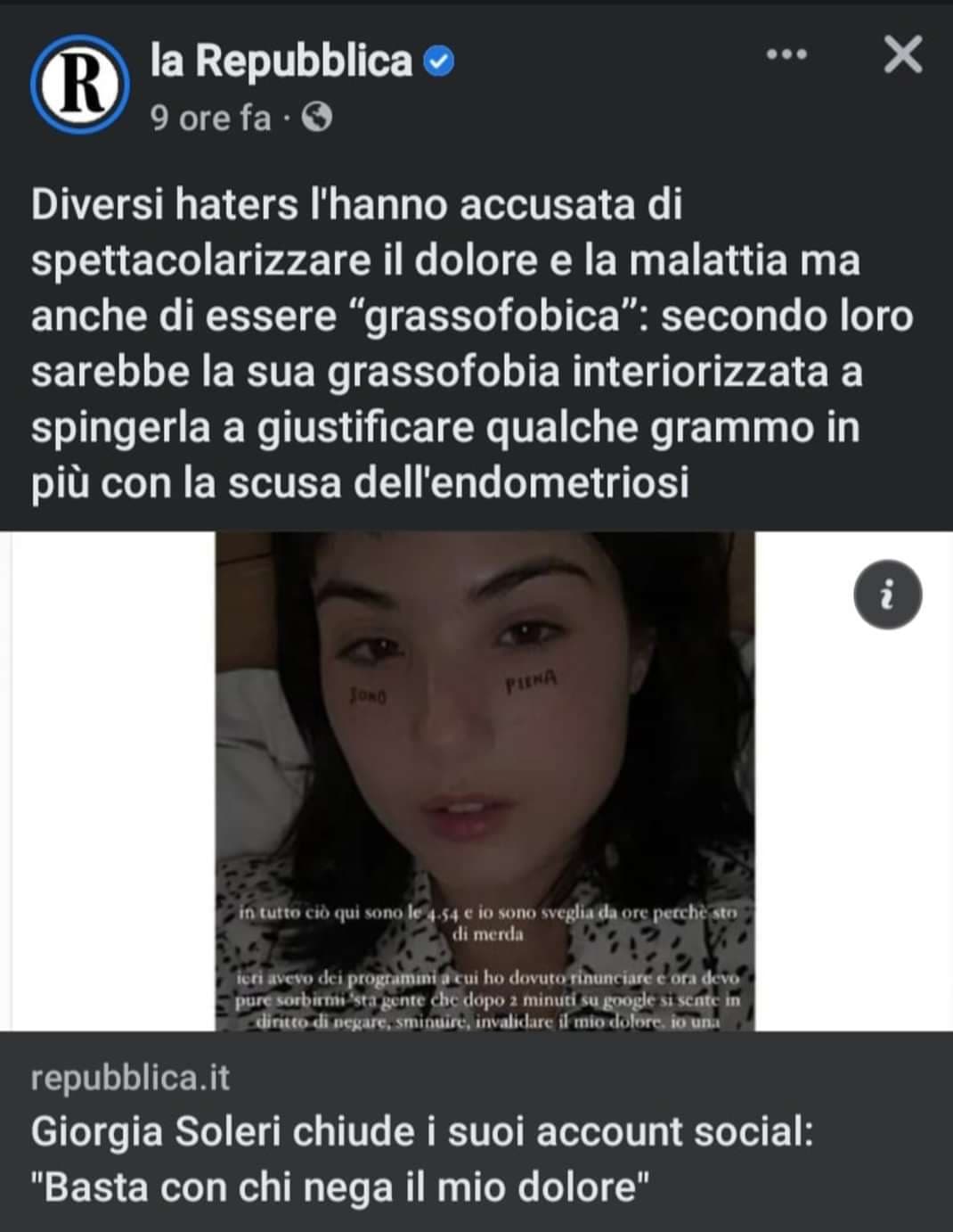 Come fai a smentire chi ti accusa di spettacolarizzarti?