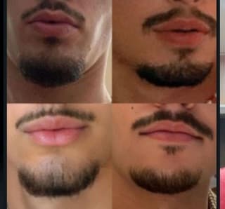 Quale dovrei fare?