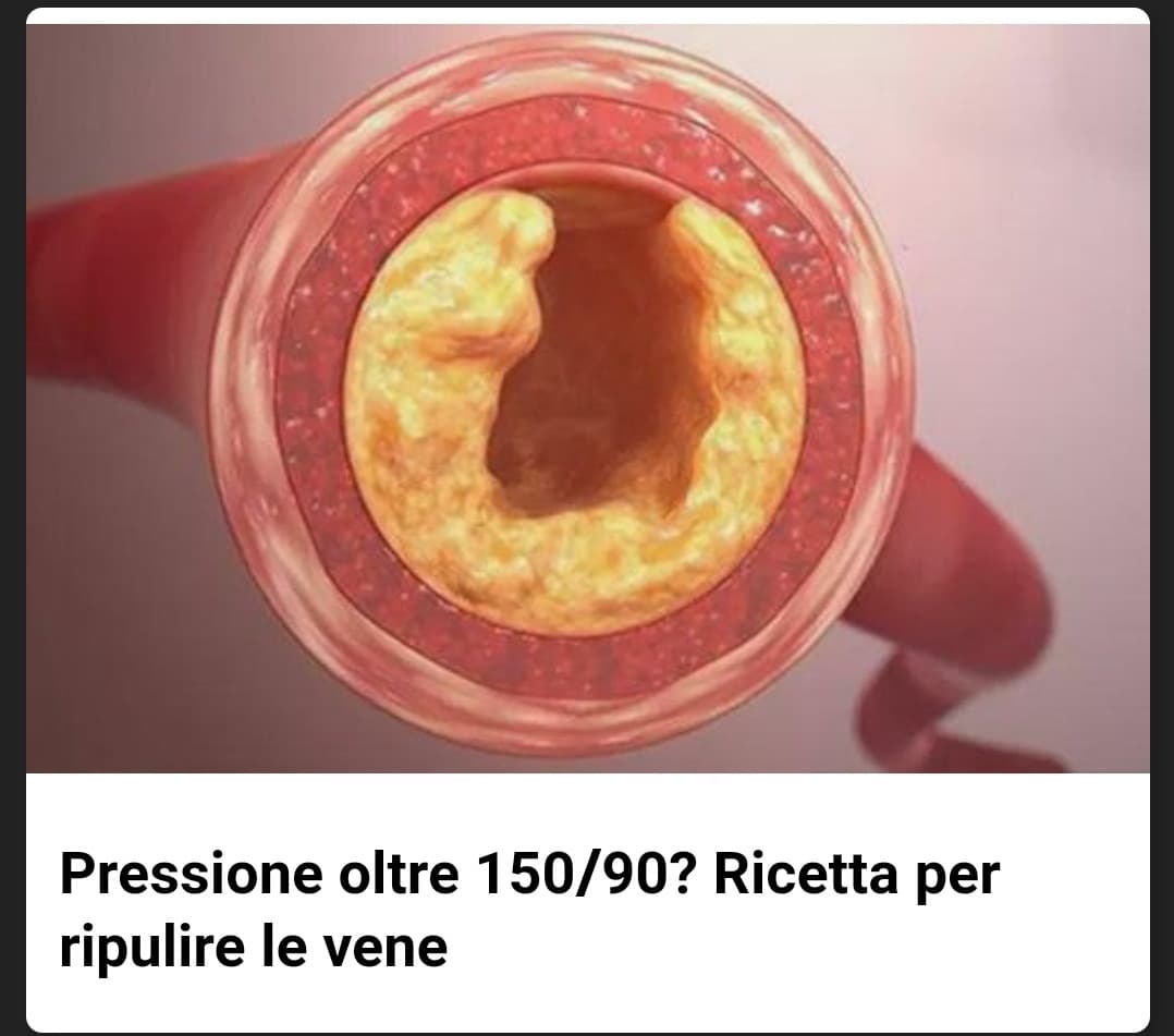 Avevo visto altro e non una vena ??