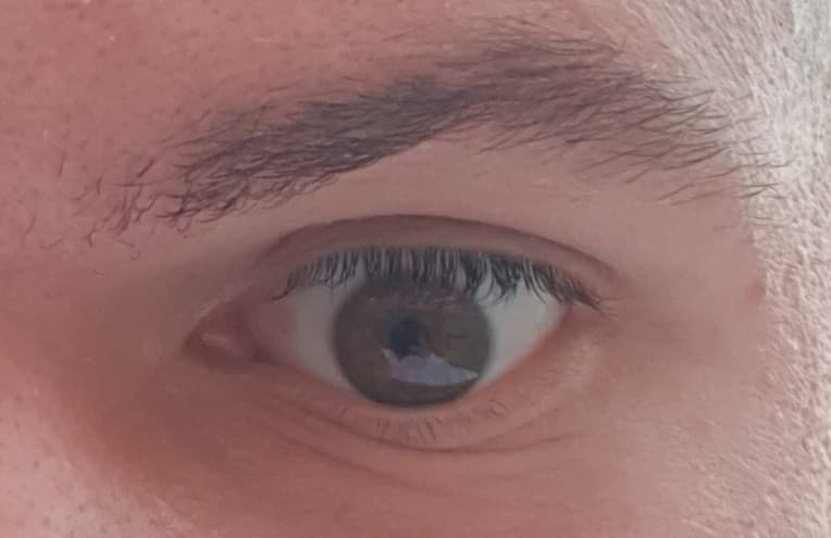 L'occhio di uno che ha i pantaloni sgangati ostruiti dalla smerdazione e dalla piscia.....
 (ho appena fatto il mio primo colloquio di lavoro SERIO IN UNA DITTA CON I CONTROCAZZI ed ero tesissimo).