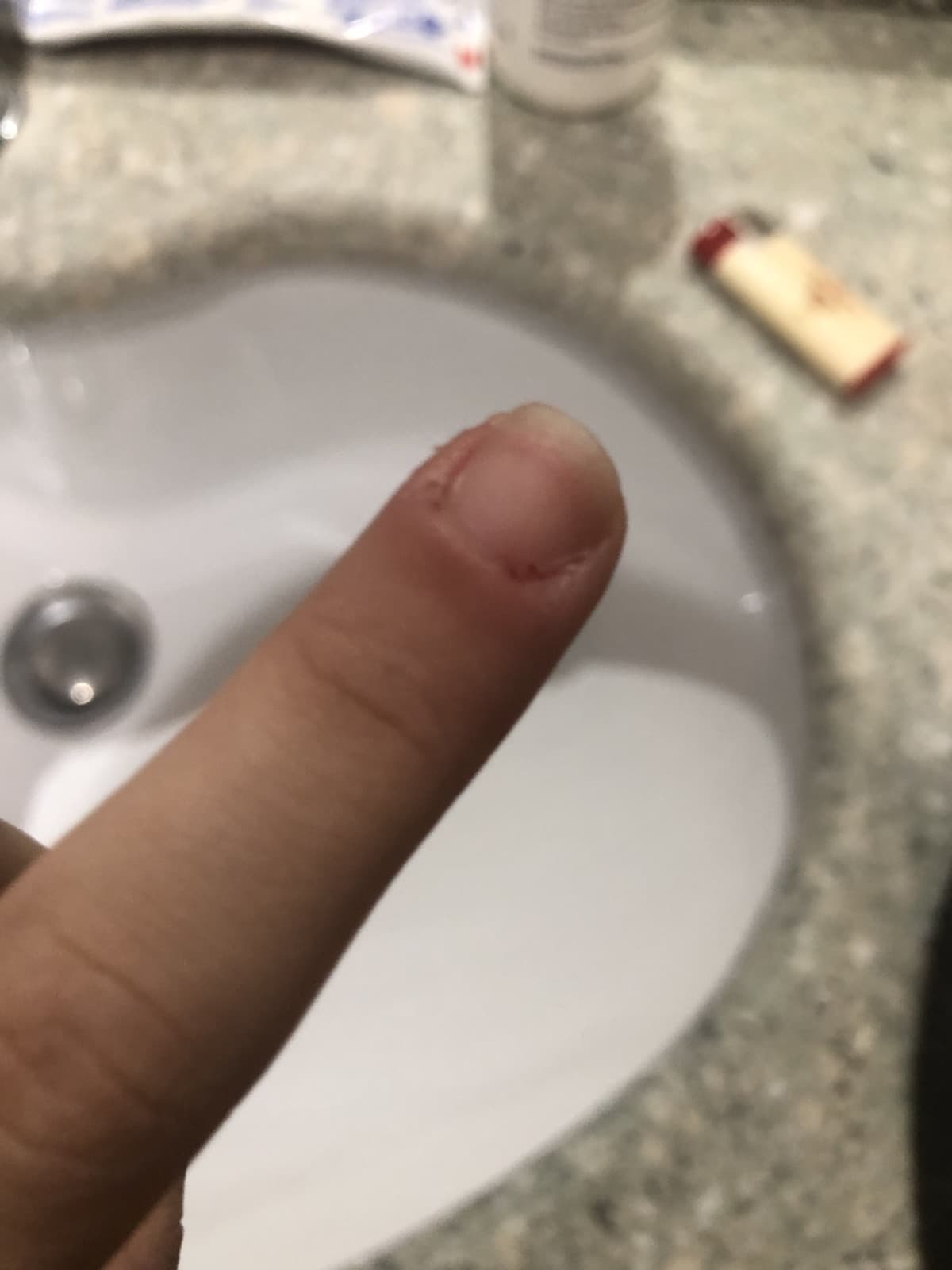 Io che imparo che forse è meglio non provare a farsi una ricostruzione da sola