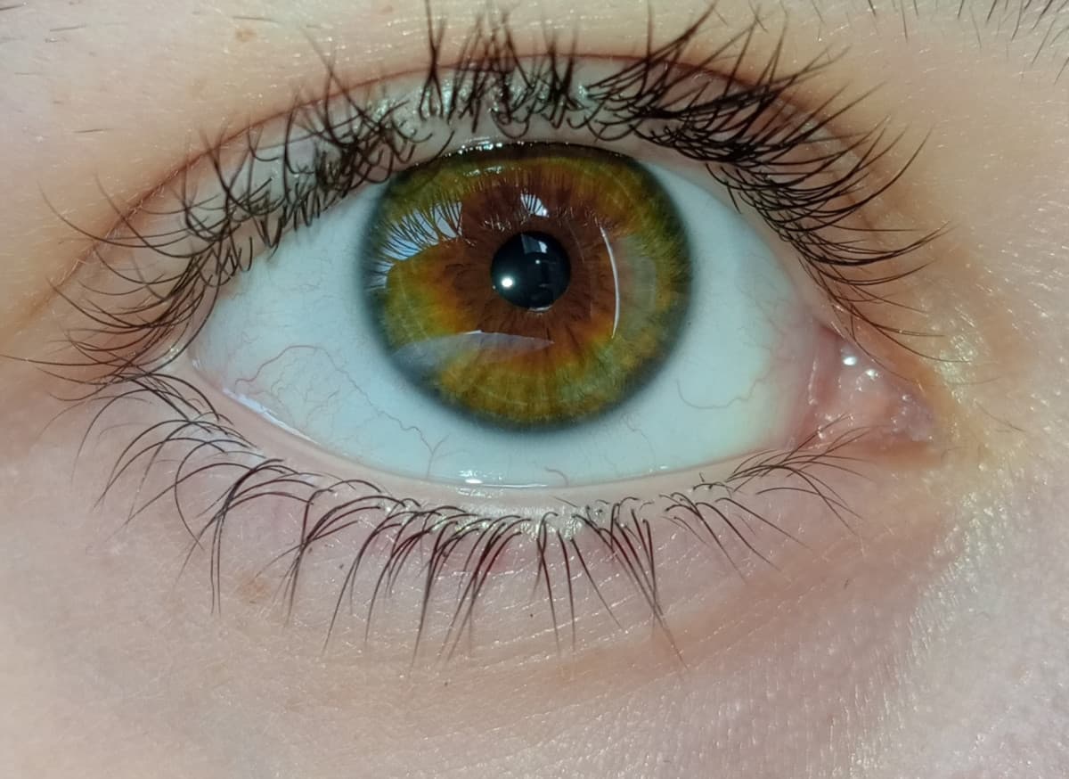 Ora esco anch'io il mio occhio