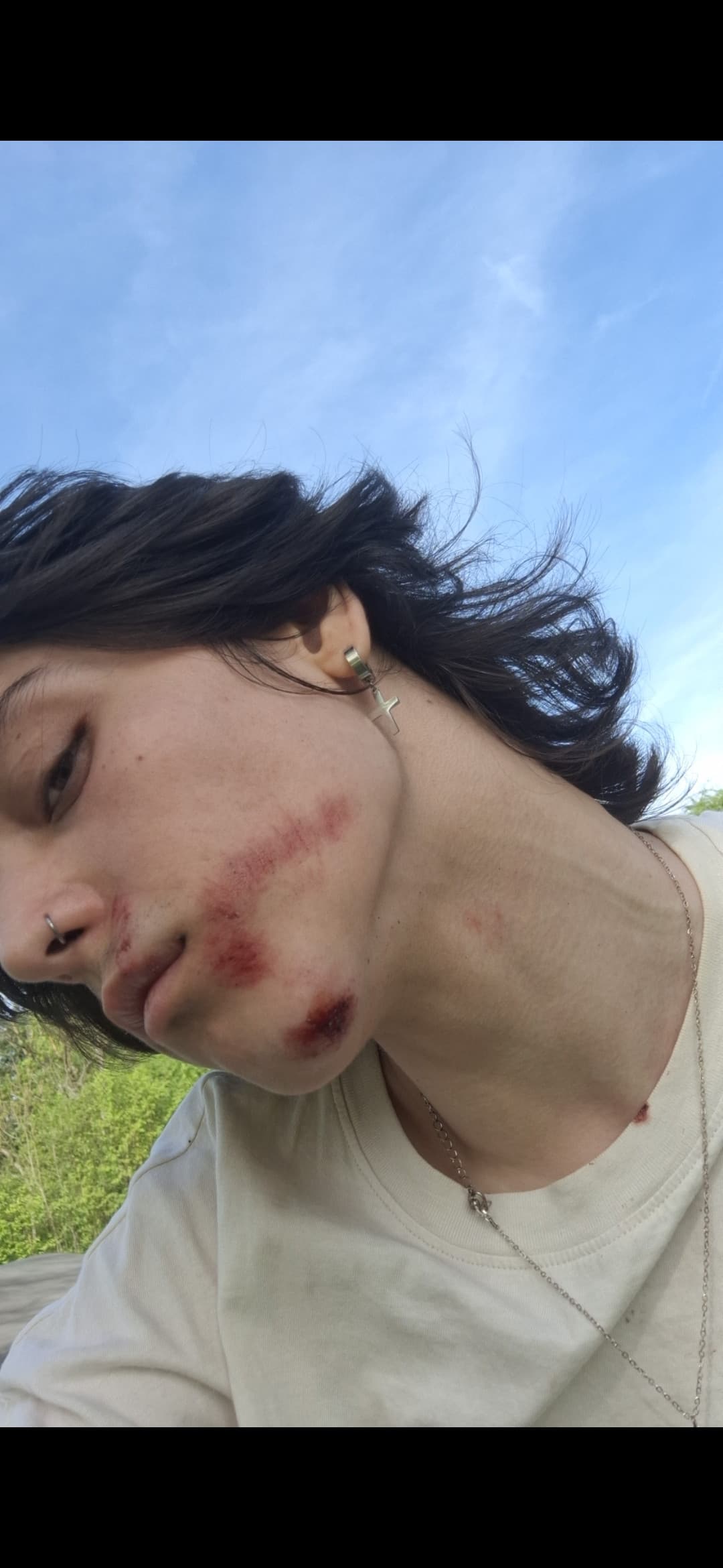 oggi ho fatto bua (pumptrack ho provato a saltare e poi atterrare dentro ad una ciotola ma dentro la ciotola ci è atterrata la mia faccia)