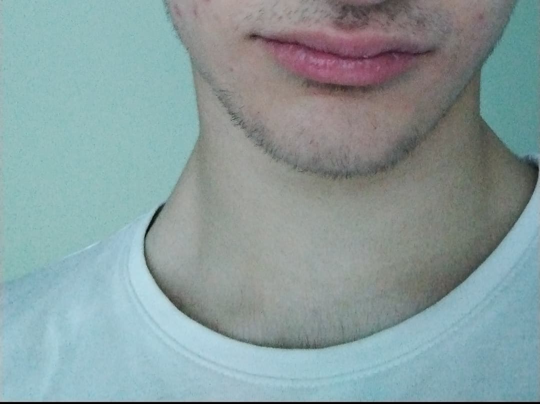 Raga ho le labbra spaccate e gonfie mi serve aiuto