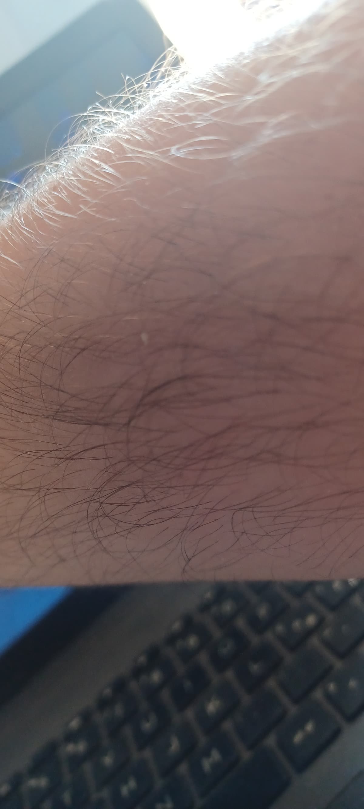 Troppo peloso? Ho dei complessi sui miei peli e visto che l'opinione dell'altro normalmente mi conta poco non mi fido delle persone che mi sono vicine