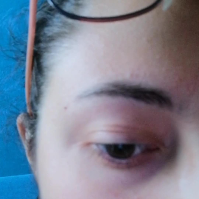 É tipo da 3 giorni che mi trema cosí l'occhio ad intermittenza, secondo voi dovrei preoccuparmi?