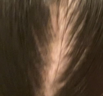 porca troia sto diventando pelata
